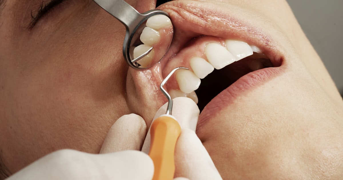 Orthodontic Plaque Management: Why Fixed Appliances Need a Different Approach